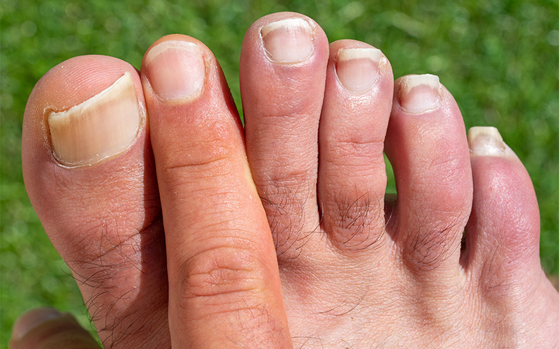 Nail Care tips for healthy and strong nails