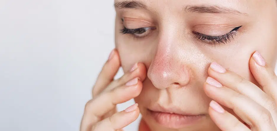Sensitive Skin

