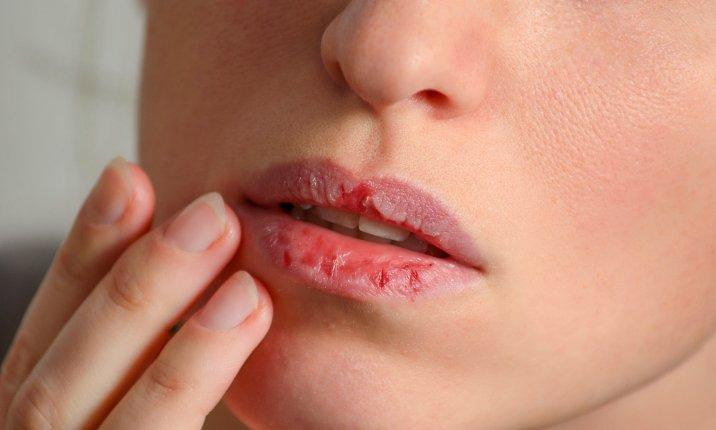 Soft Lips care routine for soft and smooth lips 